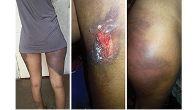 Police ‘brutality’ – Women ‘battered’ for lockdown defiance