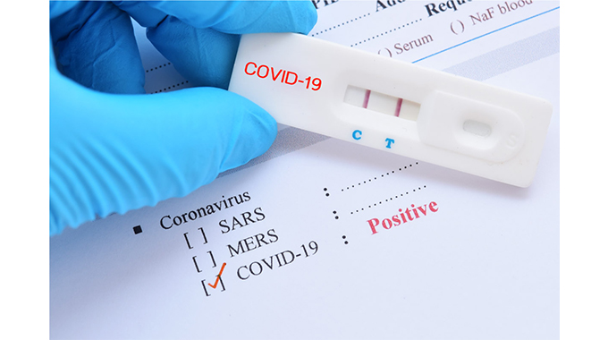 JUST IN: Zim Covid-19 active cases go up