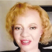 Star studded lineup for Mr and Miss Albinism Southern Africa